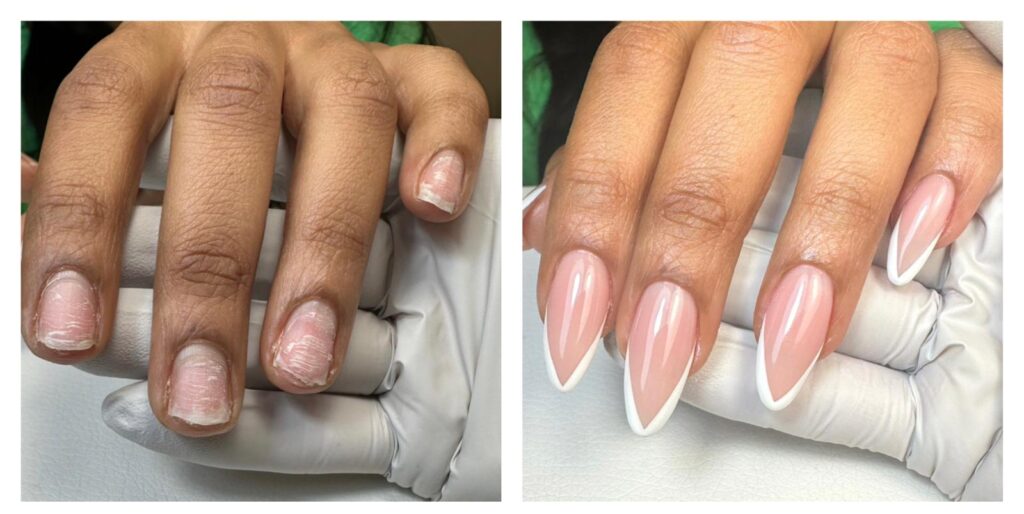 two female hands before and after nail extension